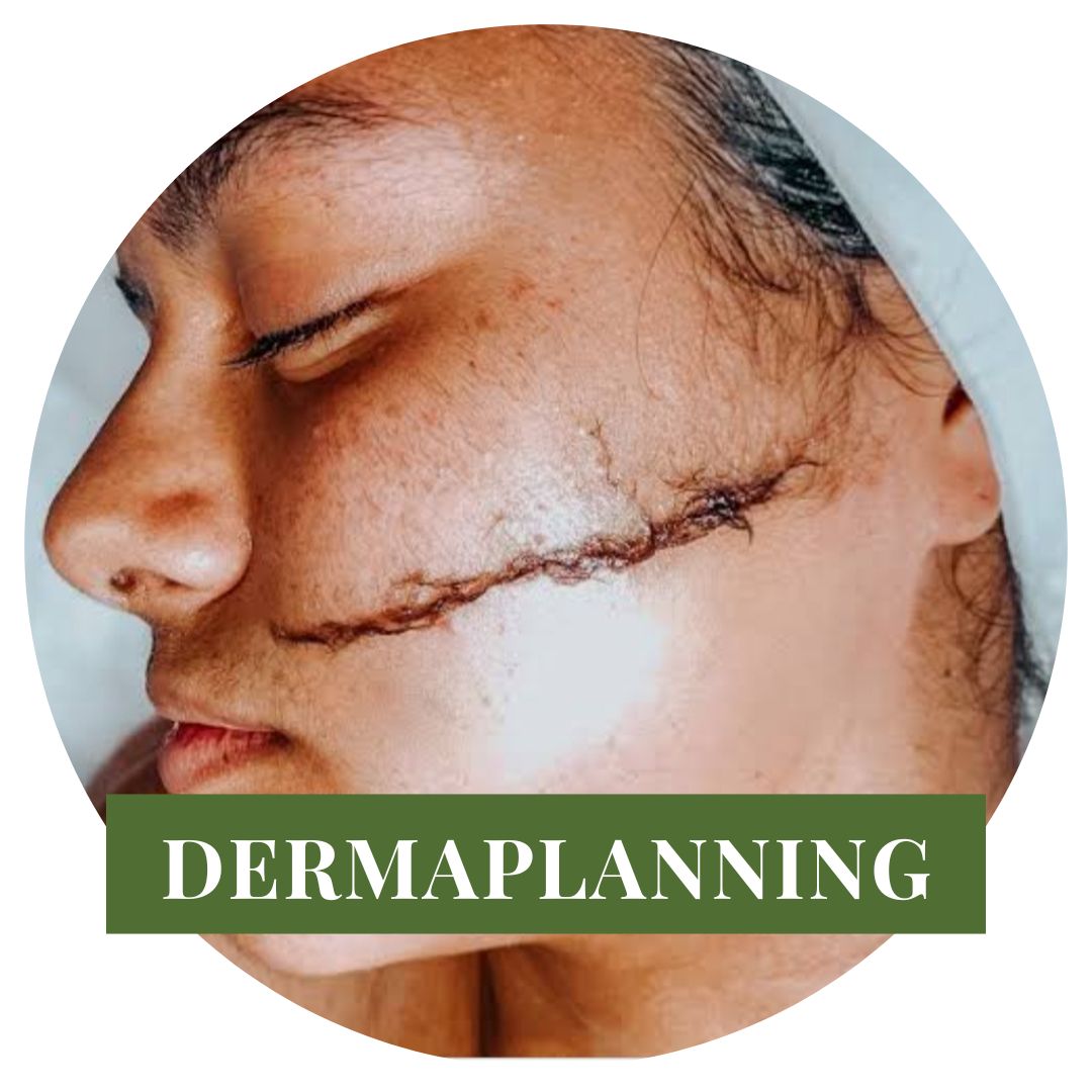 Derma planning
